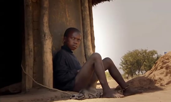 Mysterious 'nodding disease' kills children and confounds health experts